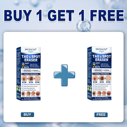 Coredew®👩‍⚕️ 𝟕-𝐃𝒂𝘆 𝐒𝗸𝐢𝐧 𝐓𝒂𝗴 & 𝐒𝐩𝙤𝐭 𝐄𝐫𝒂𝐬𝙚𝐫 Painless & Scar-Free Advanced Imperfection Removal Rollerball Pen