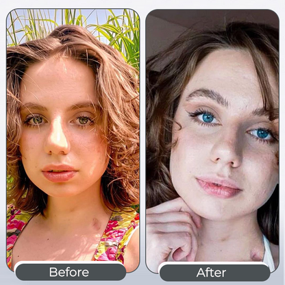 Acezozla® EyeCandy Drops🔥Best Value Natural Eye Tone Enhancer, Skip Colored Contacts, Long Lasting Comfort Eye Beauty Cosmetic