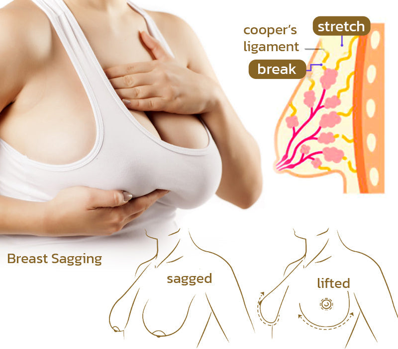 Cavebit Breast Boost & Firm Micro‑Needle Patches