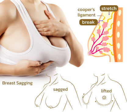 Cavebit Breast Boost & Firm Micro‑Needle Patches